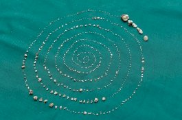 Ngeri! Dokter Cabut 526 Gigi Dari Mulut Bocah Ini