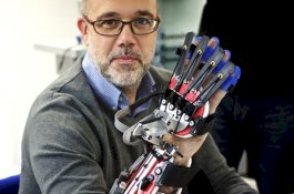 Portable, Terapi Robotik Terbukti Pulihkan Fungsi Organ Penderita Stroke