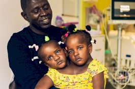 Ayah Kembar Siam Hancur Harus Memilih Salah Satu Putrinya Dibiarkan Mati