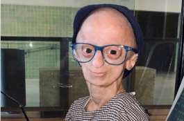 Umurnya Baru 20 Tahun, Tapi Wanita Ini Terlihat Seperti Nenek-Nenek