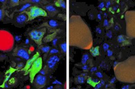 Ilmuan Berhasil Ubah Sel Kanker Payudara Menjadi Lemak