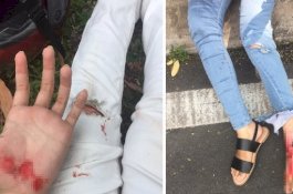 Dibegal Saat Belikan Kue Ultah untuk Adiknya, Wanita Ini Terseret di Jalan