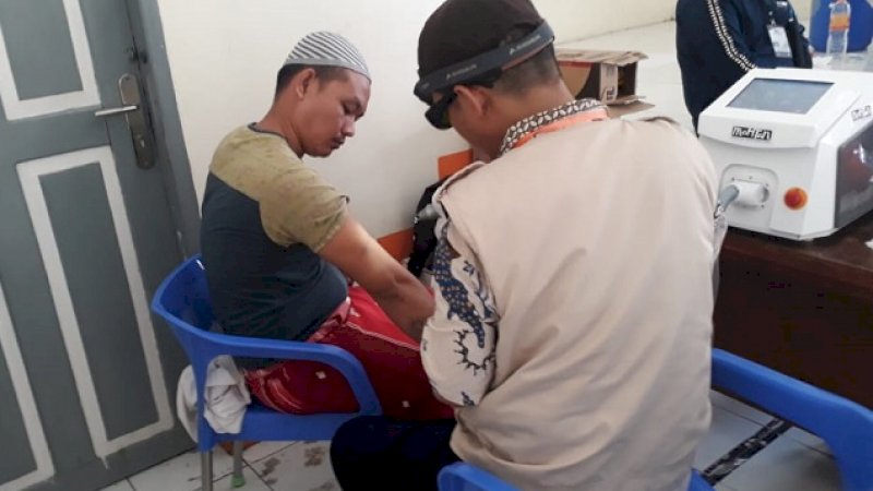 Layanan hapus tato oleh Mahtan.