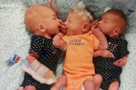 Wanita ini Kira Dirinya Menderita Batu Ginjal, Rupanya Hamil Kembar Tiga