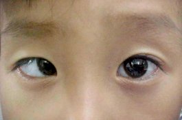 Main Game 10 Jam Sehari, Mata Bocah 9 Tahun Ini Jadi Juling