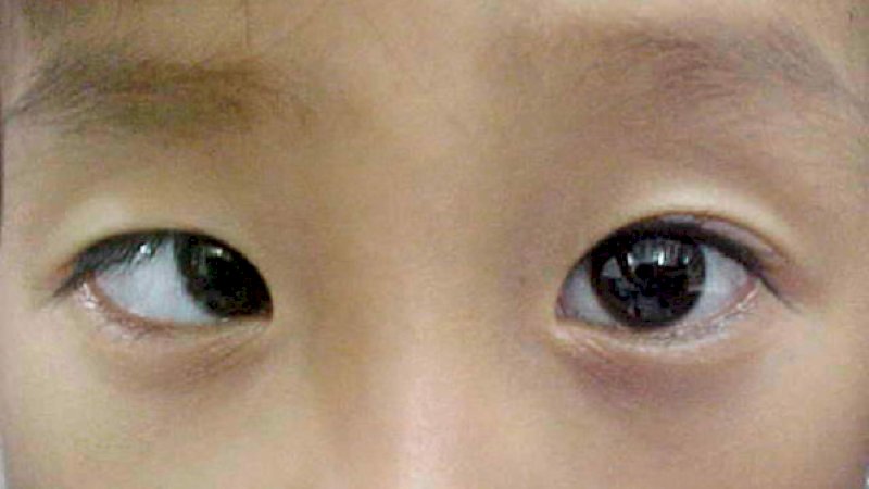 Main Game 10 Jam Sehari, Mata Bocah 9 Tahun Ini Jadi Juling