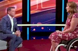 Wanita Ini Lumpuh Usai Sering Pinjam Kuas Make Up Teman