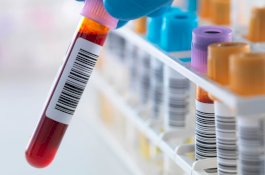 Ilmuan Temukan Cara Prediksi Kematian 10 Tahun Kedepan Lewat Darah