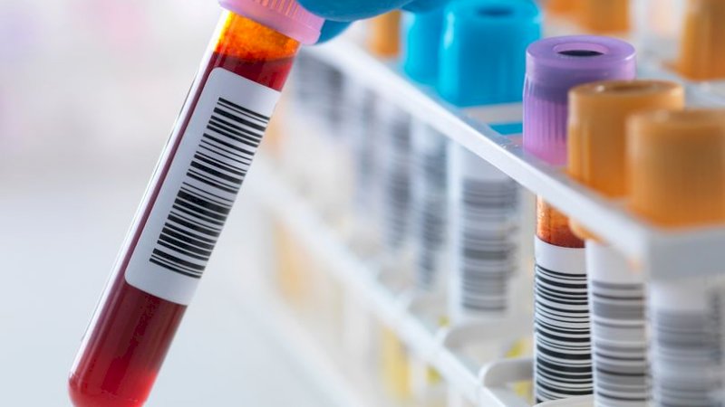 Ilmuan Temukan Cara Prediksi Kematian 10 Tahun Kedepan Lewat Darah