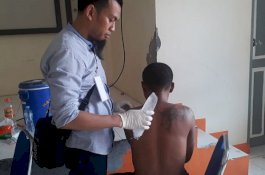 Sabtu, Warga Enrekang Bisa Hapus Tato Gratis