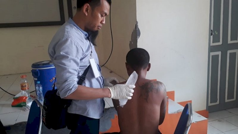 Layanan hapus tato gratis dari Mahtan. (FOTO: IST)