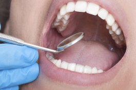 5 Masalah Kesehatan Mulut dan Cara Mencegahnya