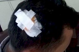 Pengakuan Oknum Polisi di Rumah Bidan Desa Bikin Warga yang Menggerebek Terancam Hukuman