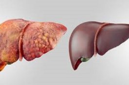 Lakukan 4 Hal ini untuk Mendetoksifikasi Hati!