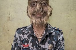 16 Anak Alami 'Sindrom Werewolf' Setelah Minum Obat Terkontaminasi