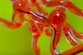 Ilmuan Ciptakan Robot Seperti Ular untuk Masuk ke Otak Manusia