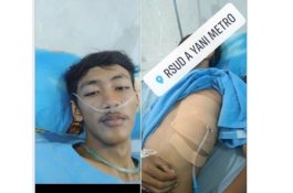 Viral, Kisah Pria Kapok Merokok Setelah Paru-parunya Tak Berfungsi Normal