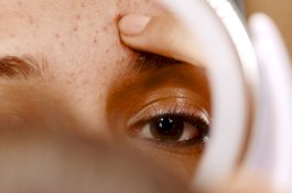 Jerawat Selama Kehamilan: Perawatan dan Obat yang Harus Dihindari