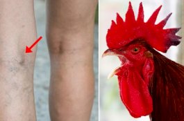 Wanita Lansia Tewas Dipatuk Ayam Saat Mengumpulkan Telur