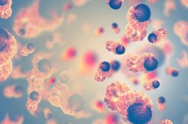 Waspadalah! Kegiatan Sehari-Hari Ini Dapat Membuat Anda Terkena Kanker