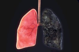 Anda Perokok, Begini Cara Membersihkan Paru-parumu