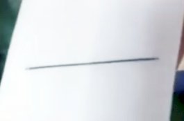 Temukan Jarum di Hati Gadis, Dokter Bingung