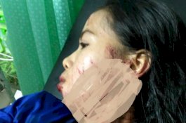 Seharian Keluar dan Lupa Memasak, IRT di Bone Dianiaya Suami