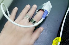 Semobil Nia Daniaty saat Kecelakaan, Ini Kesaksian Imaniar yang Ikut Terluka