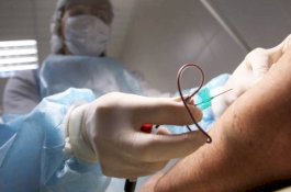 6 Pria Singapura Terinfeksi HIV Setelah Berhubungan Seks Sesama Jenis dengan Pria Malaysia