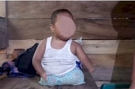 Belajar dari Semangat Rezki, Balita 2 Tahun yang Hidup Tanpa Tangan dan Kaki di Gowa