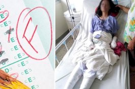Guru Membuat Gadis Bereksperimen Demi Lulus Ujian, Sayang Dia Terbakar Parah
