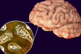 Lewat Hidung, Amoeba Makan Otak Gadis Ini