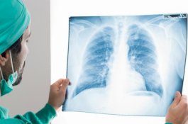 Jenis Pekerjaan yang Berisiko Bagi Paru-Paru