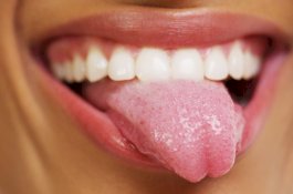 Kena Kanker, Lidah Wanita Ini Diganti dengan Kulit Tangan