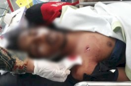 Mahasiswa UHO Tewas saat Ikut Demo, Ada Luka Diduga Tembakan di Dada