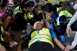 Jurnalis Indonesia yang Tertembak di Hongkong Bisa Buta Permanen