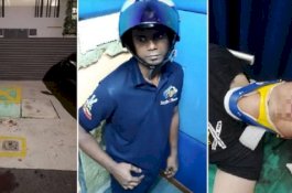 Dirampok 3 Pria, Penyewa Kondominium Koma di Rumah Sakit