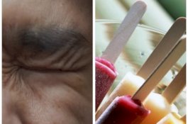 Gadis 11 Tahun Lolos dari Pemerkosaan Setelah Colok Mata Pelaku dengan Tusuk Es Krim