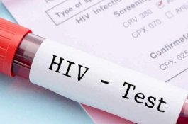 Palsukan Data selama 5 Kali Donor Darah, Ternyata Positif HIV