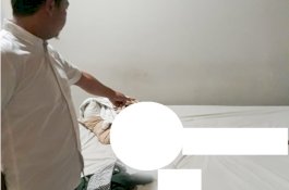 Ditemukan Tewas Tanpa Busana di Kamar Hotel, Ada Tato di Kaki Kanan Perempuan Ini