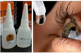 Dikira Obat Tetes Mata, Bocah 5 Tahun Tetesi Matanya Pakai Lem Korea