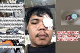 Kena Abu Rokok Pengendara saat Naik Motor, Selaput Darah Mata Pria Ini Pecah