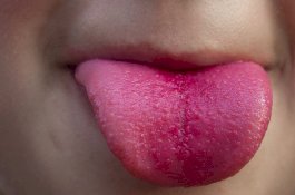 Disuruh Cari Kerja, Suami Potong Lidah Istri