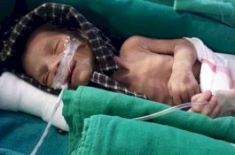 Bayi Prematur Selamat Walau Sudah 2 Hari Dimasukkan ke Liang Kubur