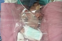 Satu Lagi Wanita Lanjut Usia di India Melahirkan Bayinya