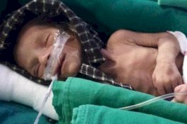 Bayi Baru Lahir yang Ditemukan Dikubur Hidup-hidup Kini Berjuang untuk Hidup