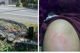 Kabel Telkom Berulah Lagi, Wanita di Bulukumba Terjungkal karena Tersangkut