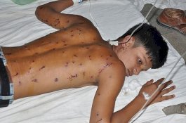 Polisi Tembaki Demonstran Bela Nabi Muhammad di Bangladesh, 4 Orang Tewas