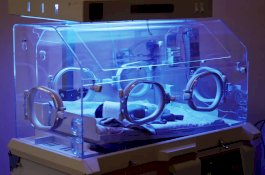 Tragis, Bayi Tiga Bulan Terbakar Dalam Inkubator Rumah Sakit