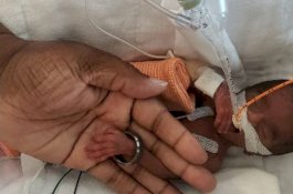 Bayi yang Lahirnya Lebih Kecil dari Boneka Barbie Secara Ajaib Bertahan Hidup